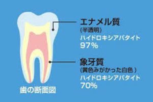 象牙質No2