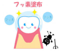 フッ素塗布