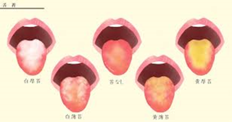舌苔の付着